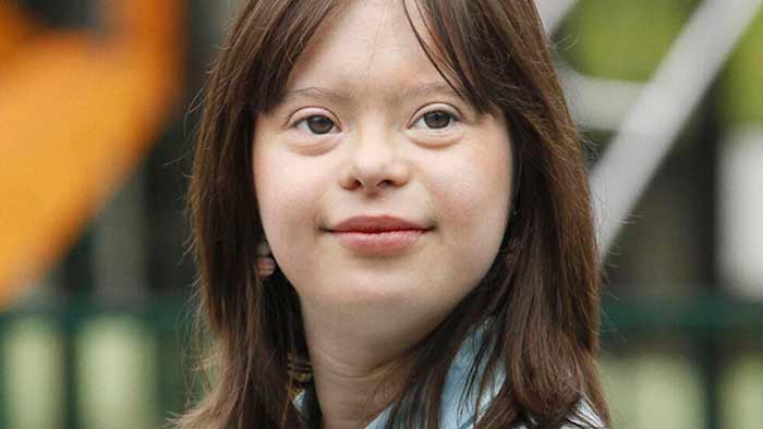 تفاوت کودکان استثنایی با کودکان عادی (علائم واضح)